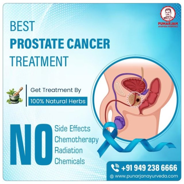 Best Prostate Cancer Treatment Hospital in Bangalore