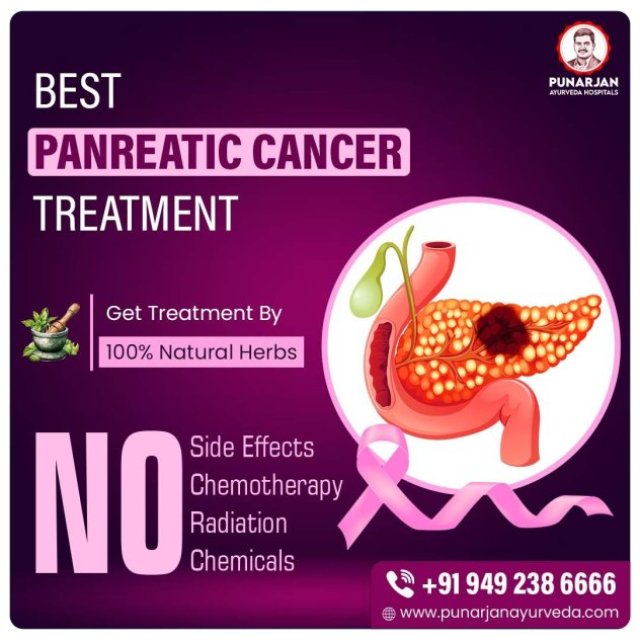Best Pancreatic Cancer Treatment Hospitals in Bangalore