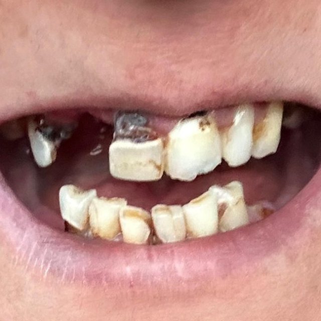 Dental Care North York | Glenoakdental.ca