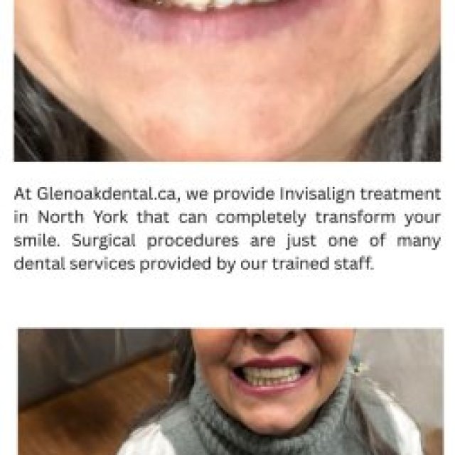 Invisalign Treatment North York | Glenoakdental.ca