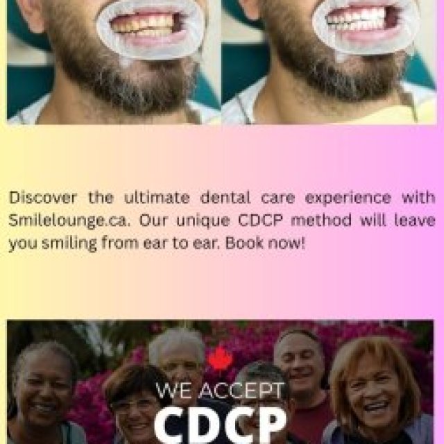 CDCP | Smilelounge.ca