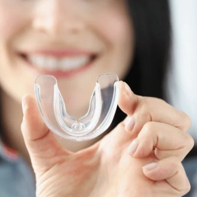 Dental Mouth Guards Milton | Smilelounge.ca