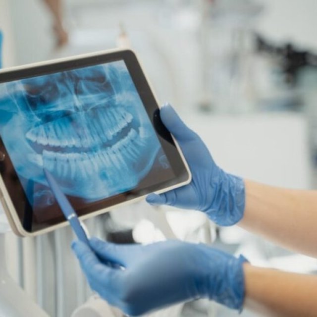 Dentist Meadowvale Town Centres | Meadowvaledentist.ca