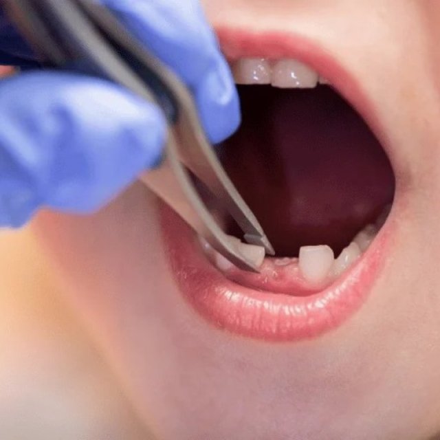Pediatric Dentist Milton Ontarioc | Smilelounge.ca