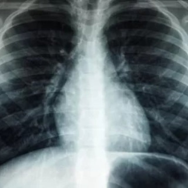 Tomografía computarizada de abdomen 3D trifásica en Ecuador: diagnóstico preciso
