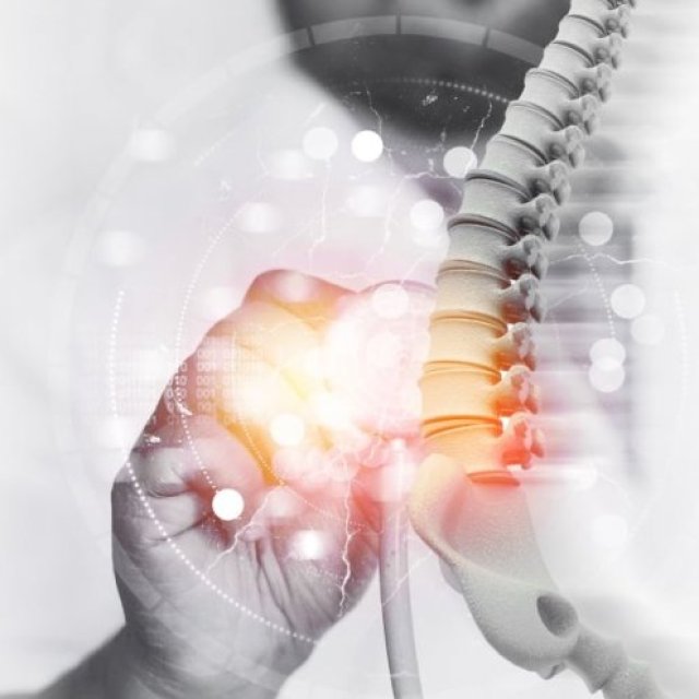 Interventional Spine Doctor Tribeca Nyc | Robertfmancusomd.com