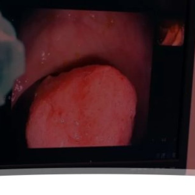 Precio de endoscopia: pruebas diagnósticas y preventivas asequibles