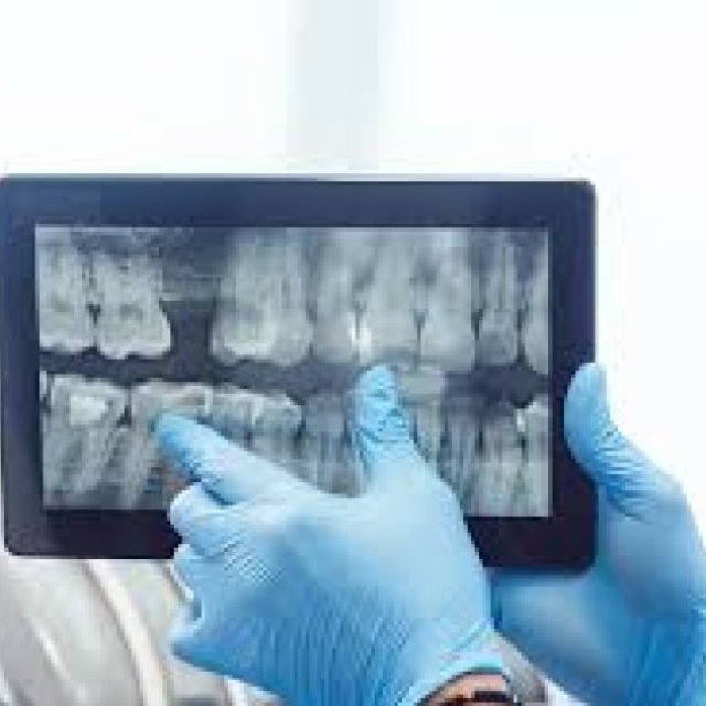 Bothell Orthodontist