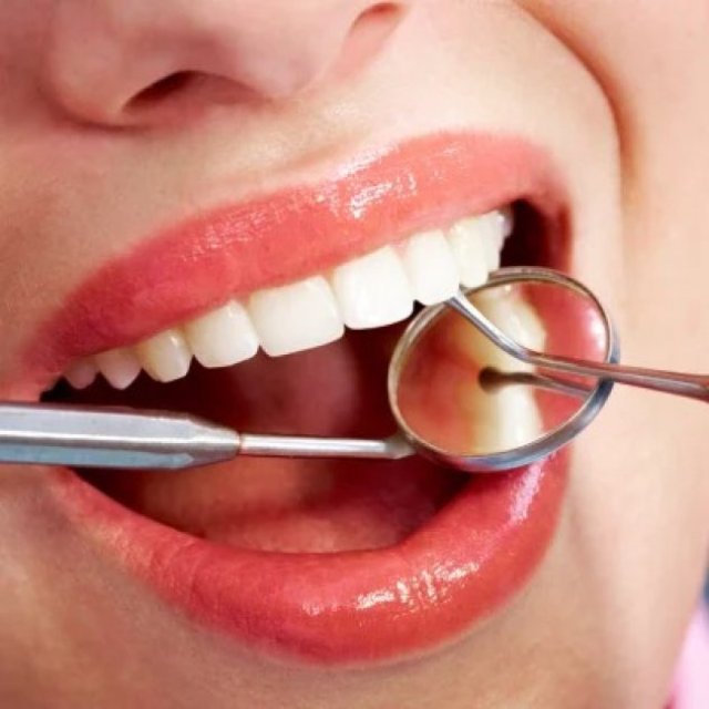 Emergency Dental Clinic in London, Ontario - Open Now