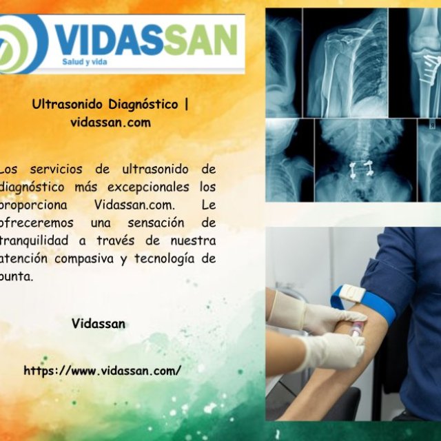 Ultrasonido Diagnóstico | vidassan.com