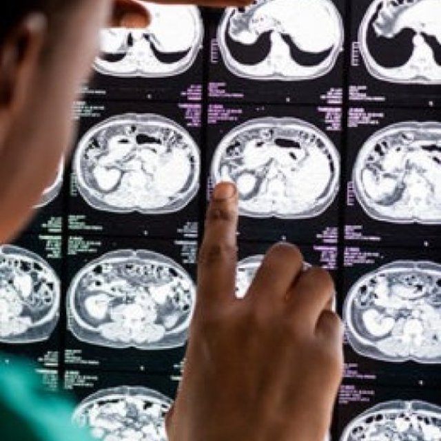 Advanced Pain Management Surgery in Lagos