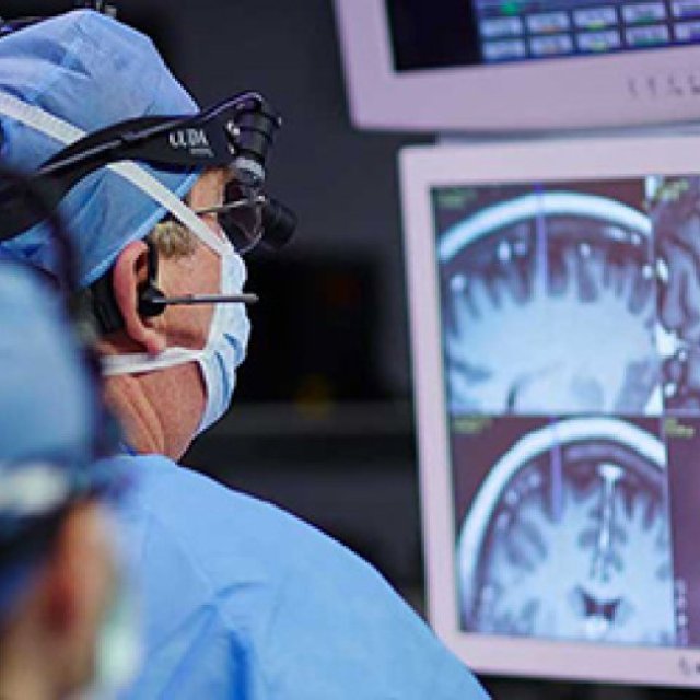 Cheap Price Deep Brain Stimulation Therapy India