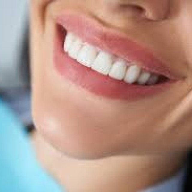 Clackamas Invisalign