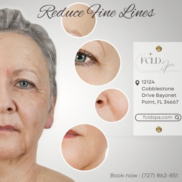 Youthful Skin Rejuvenation in Hudson FL