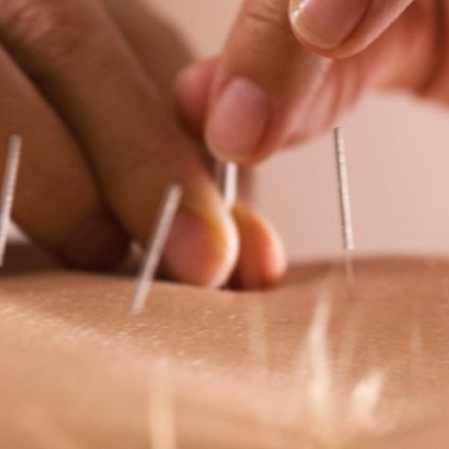 InMotion Acupuncture