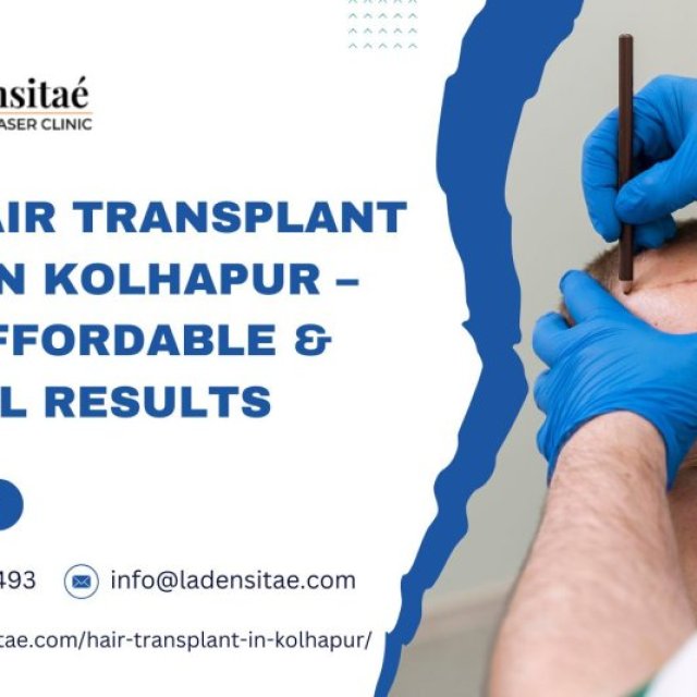 Best Hair Transplant Clinic in Kolhapur - Safe, Affordable & Natural Results