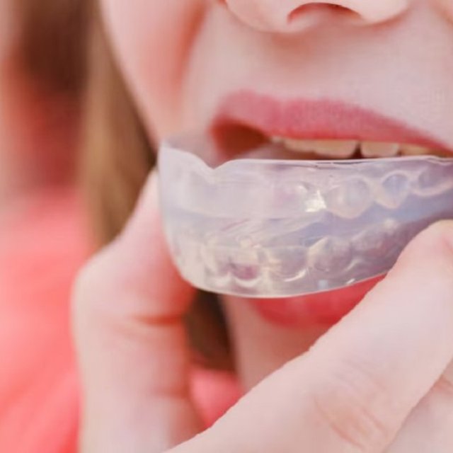 Mouth Guard Wyndham Vale | 32 Pearls Dental Surgery