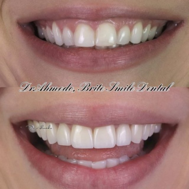 Brite Smile Dental-Dentist in San Diego