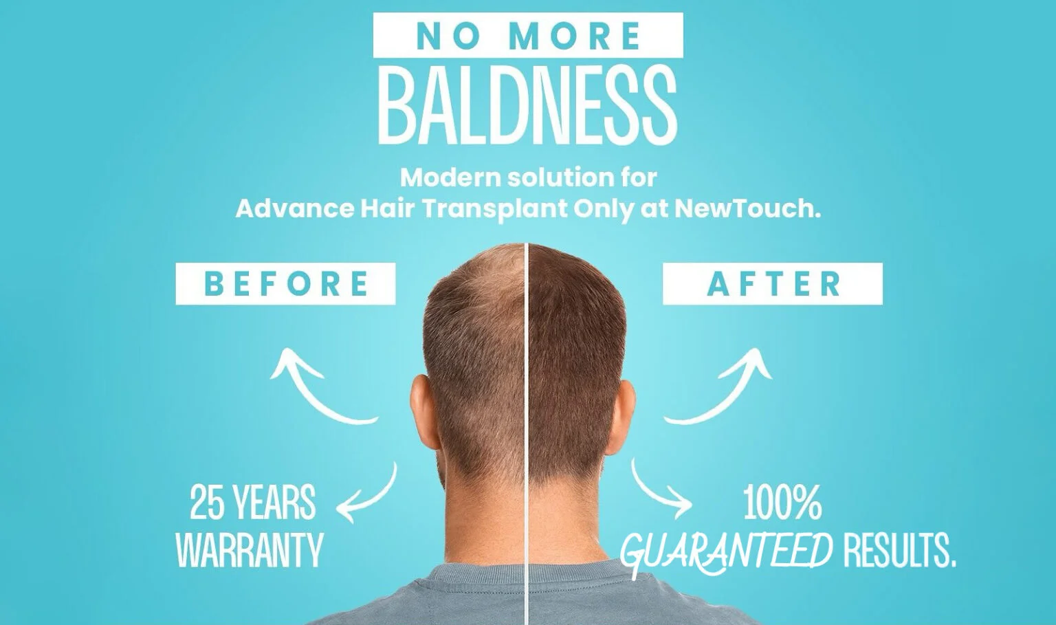 New Touch Skin & Hair Care Clinic - Hair Transplant Clinic in Ahmedabad